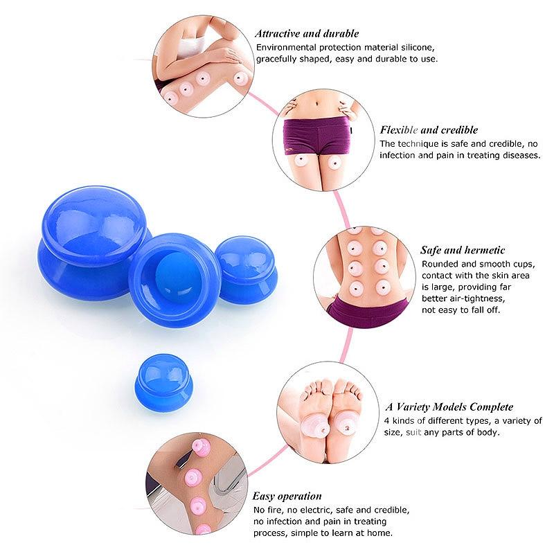 4-Piece Silicone Cupping Therapy Set For Body Massage - Blue